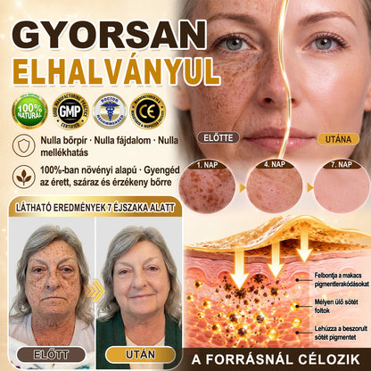🎁 Már csak 5 doboz Hiskin® maradt! Spóroljon extra 30%-ot még ma – támogassa bőre ragyogóbb, simább és egyenletesebb megjelenését, mielőtt véget ér ez a korlátozott idejű ajánlat!