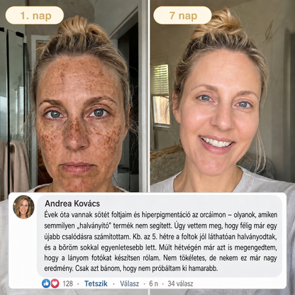 🎁 Már csak 5 doboz Hiskin® maradt! Spóroljon extra 30%-ot még ma – támogassa bőre ragyogóbb, simább és egyenletesebb megjelenését, mielőtt véget ér ez a korlátozott idejű ajánlat!
