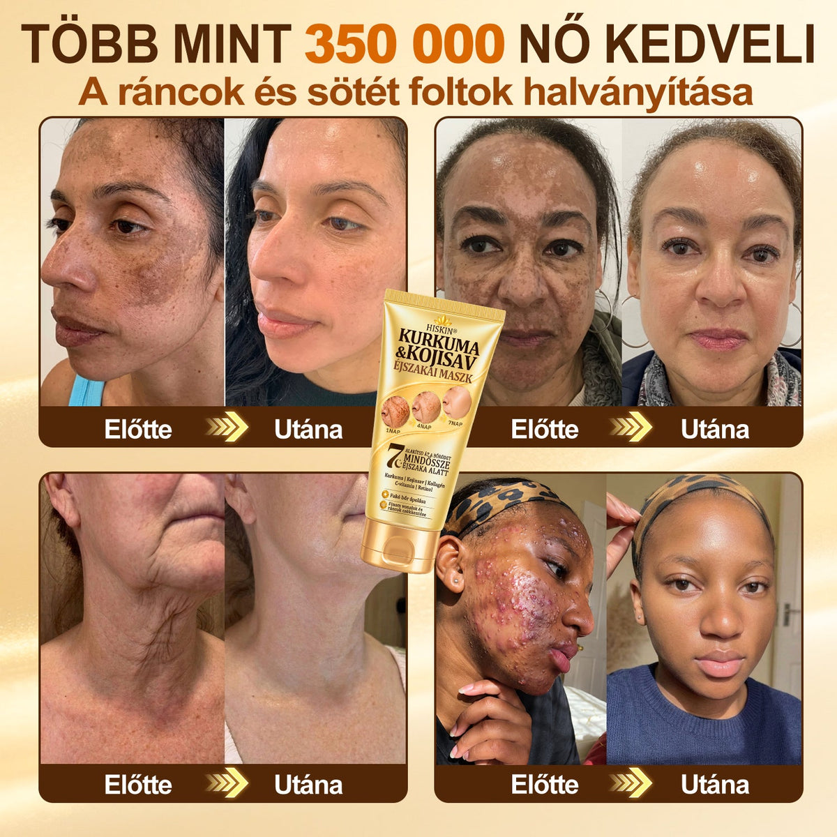🎁 Már csak 5 doboz Hiskin® maradt! Spóroljon extra 30%-ot még ma – támogassa bőre ragyogóbb, simább és egyenletesebb megjelenését, mielőtt véget ér ez a korlátozott idejű ajánlat!