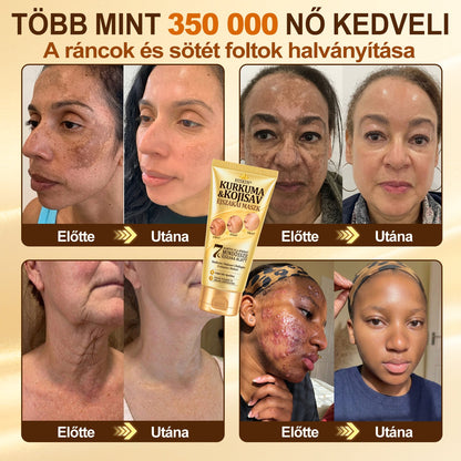 🎁 Már csak 5 doboz Hiskin® maradt! Spóroljon extra 30%-ot még ma – támogassa bőre ragyogóbb, simább és egyenletesebb megjelenését, mielőtt véget ér ez a korlátozott idejű ajánlat!
