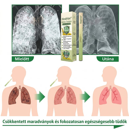 Healrize® 𝐁𝐨𝐭𝐚𝐧𝐢𝐜𝐚𝐥 𝐌𝐮𝐥𝐥𝐞𝐢𝐧 𝐋𝐮𝐧𝐠 𝐂𝐥𝐞𝐚𝐧𝐬𝐞 𝐃𝐢𝐟𝐟𝐮𝐬𝐞𝐫 (👨 𝐊ö𝐡ö𝐠é𝐬, 𝐭𝐨𝐫𝐨𝐤𝐠𝐲𝐮𝐥𝐥𝐚𝐝á𝐬, 𝐥é𝐠𝐬𝐳𝐨𝐦𝐣, 𝐯á𝐥𝐚𝐝é𝐤𝐤é𝐩𝐳ő𝐝é𝐬, 𝐨𝐫𝐫𝐝𝐮𝐠𝐮𝐥á𝐬, 𝐡ö𝐫𝐠𝐡𝐮𝐫𝐮𝐭, 𝐚𝐥𝐥𝐞𝐫𝐠𝐢á𝐬 𝐭ü𝐧𝐞𝐭𝐞𝐤, 𝐭ü𝐝ő𝐩𝐚𝐧𝐚𝐬𝐳𝐨𝐤)