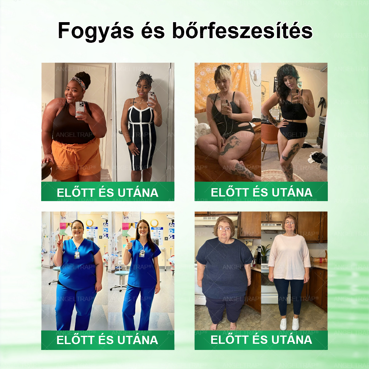 🎁 Már csak 5 doboz ANGELTRAP® maradt! Spóroljon extra 30%-ot még ma – támogassa anyagcseréjét, testsúlykontrollját és mindennapi wellness-rutinját, mielőtt véget ér ez a korlátozott idejű ajánlat!