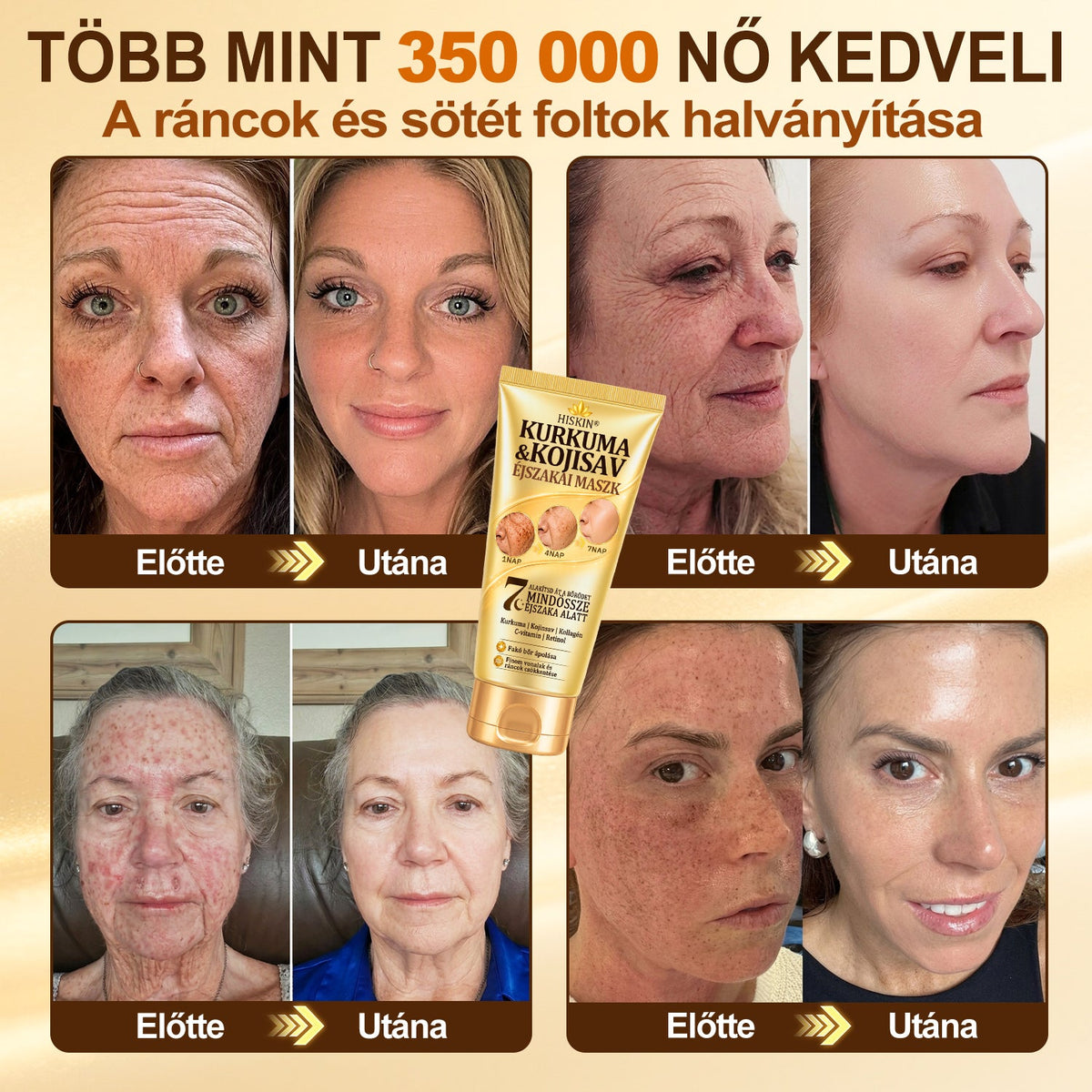 🎁 Már csak 5 doboz Hiskin® maradt! Spóroljon extra 30%-ot még ma – támogassa bőre ragyogóbb, simább és egyenletesebb megjelenését, mielőtt véget ér ez a korlátozott idejű ajánlat!