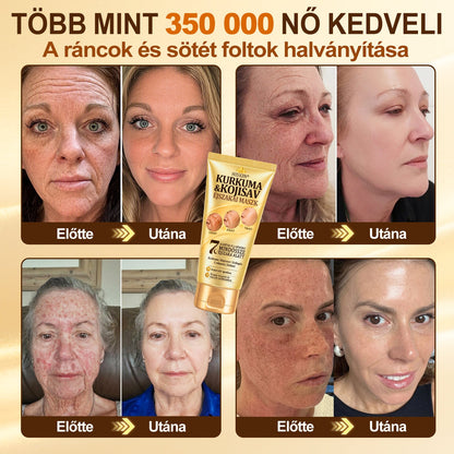 🎁 Már csak 5 doboz Hiskin® maradt! Spóroljon extra 30%-ot még ma – támogassa bőre ragyogóbb, simább és egyenletesebb megjelenését, mielőtt véget ér ez a korlátozott idejű ajánlat!