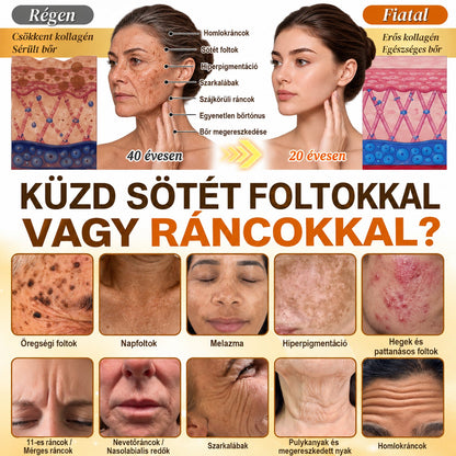 🎁 Már csak 5 doboz Hiskin® maradt! Spóroljon extra 30%-ot még ma – támogassa bőre ragyogóbb, simább és egyenletesebb megjelenését, mielőtt véget ér ez a korlátozott idejű ajánlat!