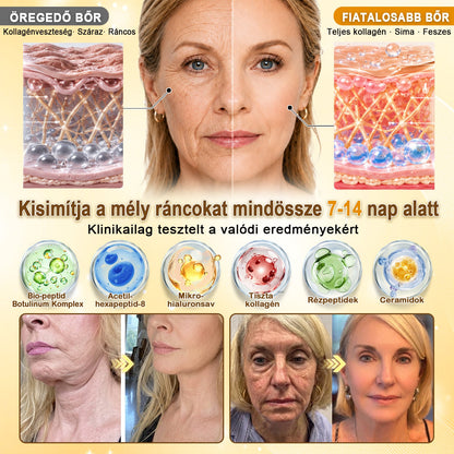 🎁 Már csak 5 doboz Hiskin® maradt! Spóroljon extra 30%-ot még ma – támogassa bőre ragyogóbb, simább és egyenletesebb megjelenését, mielőtt véget ér ez a korlátozott idejű ajánlat!