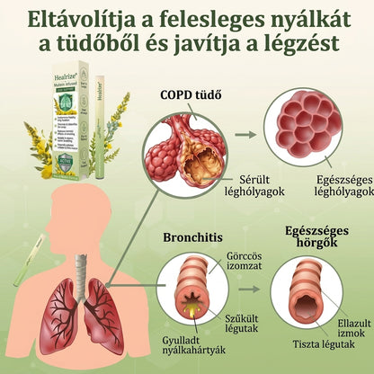 Healrize® 𝐁𝐨𝐭𝐚𝐧𝐢𝐜𝐚𝐥 𝐌𝐮𝐥𝐥𝐞𝐢𝐧 𝐋𝐮𝐧𝐠 𝐂𝐥𝐞𝐚𝐧𝐬𝐞 𝐃𝐢𝐟𝐟𝐮𝐬𝐞𝐫 (👨 𝐊ö𝐡ö𝐠é𝐬, 𝐭𝐨𝐫𝐨𝐤𝐠𝐲𝐮𝐥𝐥𝐚𝐝á𝐬, 𝐥é𝐠𝐬𝐳𝐨𝐦𝐣, 𝐯á𝐥𝐚𝐝é𝐤𝐤é𝐩𝐳ő𝐝é𝐬, 𝐨𝐫𝐫𝐝𝐮𝐠𝐮𝐥á𝐬, 𝐡ö𝐫𝐠𝐡𝐮𝐫𝐮𝐭, 𝐚𝐥𝐥𝐞𝐫𝐠𝐢á𝐬 𝐭ü𝐧𝐞𝐭𝐞𝐤, 𝐭ü𝐝ő𝐩𝐚𝐧𝐚𝐬𝐳𝐨𝐤)