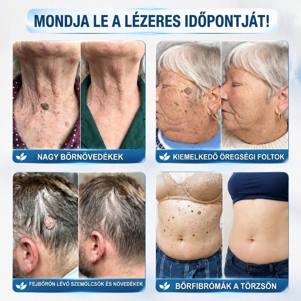 🎁 Már csak 5 doboz 𝐇𝐈𝐒𝐊𝐈𝐍® maradt! Spóroljon extra 30%-ot még ma – gondoskodjon bőre simább, feszesebb és ápoltabb megjelenéséről, mielőtt véget ér ez a korlátozott idejű ajánlat!