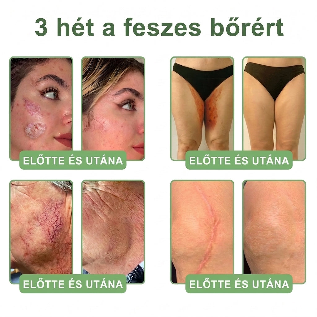 🎁 Már csak 5 üveg HISKIN® maradt! Spóroljon extra 30%-ot még ma – támogassa bőre hidratáltabb, feszesebb és fiatalosabb megjelenését, mielőtt véget ér ez a korlátozott idejű ajánlat!