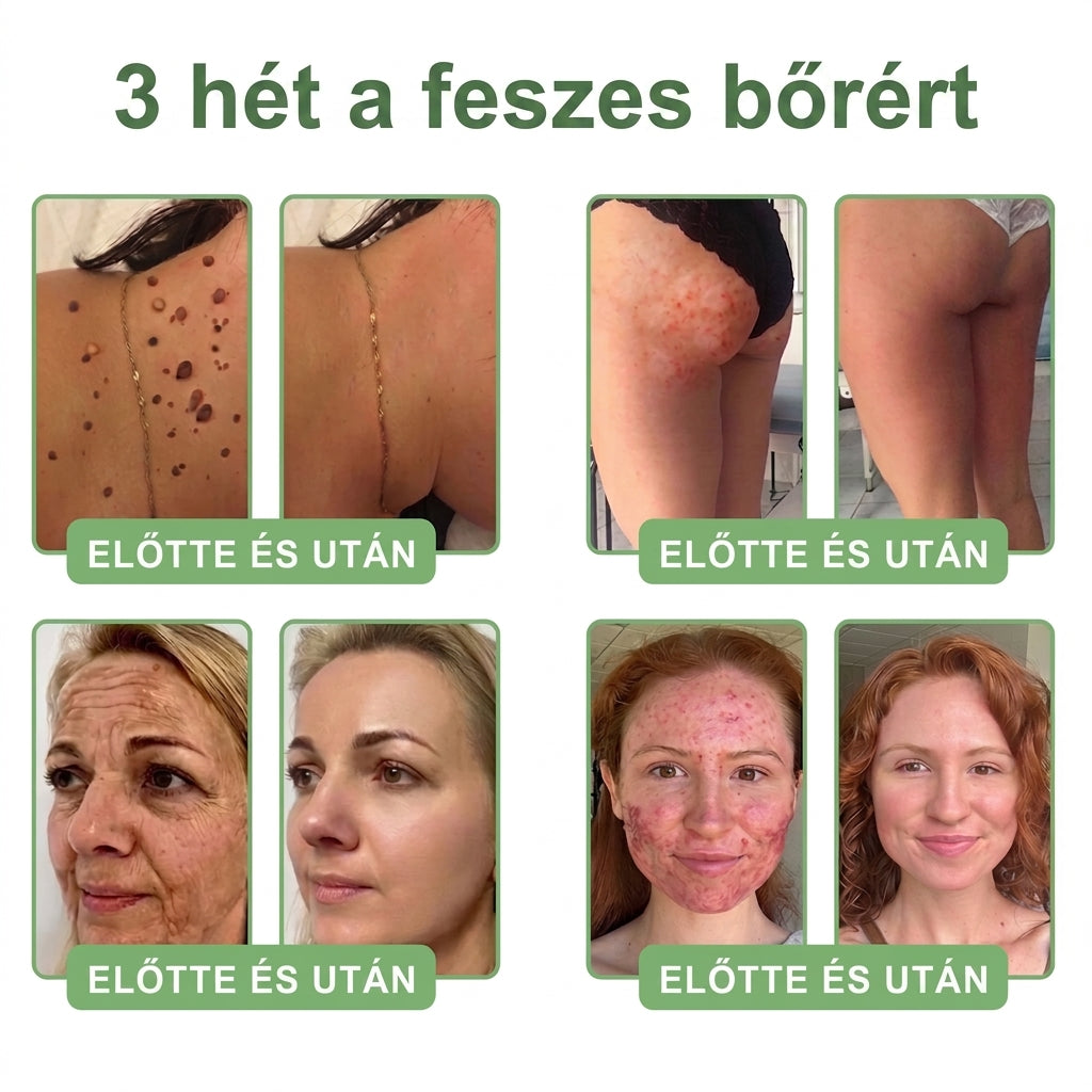 🎁 Már csak 5 üveg HISKIN® maradt! Spóroljon extra 30%-ot még ma – támogassa bőre hidratáltabb, feszesebb és fiatalosabb megjelenését, mielőtt véget ér ez a korlátozott idejű ajánlat!