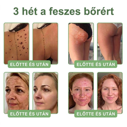 🎁 Már csak 5 üveg HISKIN® maradt! Spóroljon extra 30%-ot még ma – támogassa bőre hidratáltabb, feszesebb és fiatalosabb megjelenését, mielőtt véget ér ez a korlátozott idejű ajánlat!