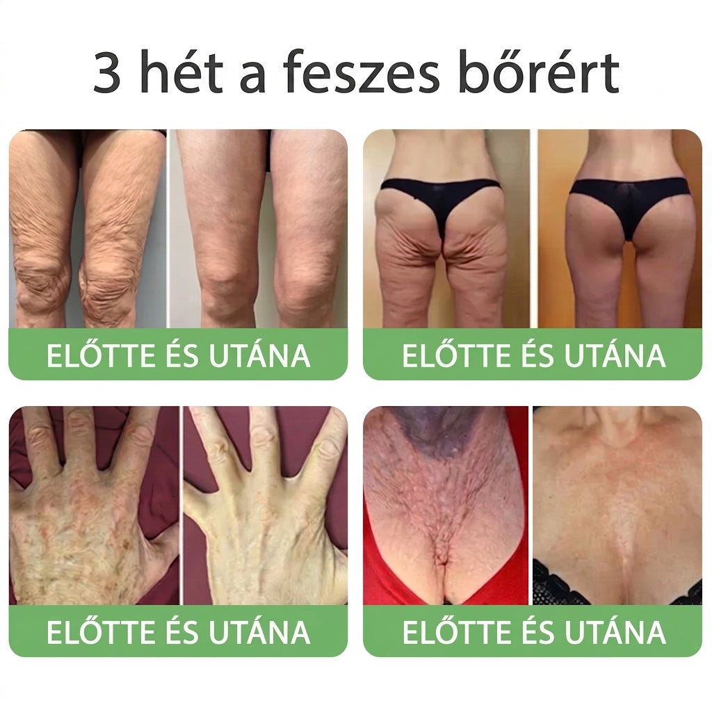 🎁 Már csak 5 üveg HISKIN® maradt! Spóroljon extra 30%-ot még ma – támogassa bőre hidratáltabb, feszesebb és fiatalosabb megjelenését, mielőtt véget ér ez a korlátozott idejű ajánlat!
