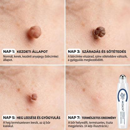 🎁 Már csak 5 doboz 𝐇𝐈𝐒𝐊𝐈𝐍® maradt! Spóroljon extra 30%-ot még ma – gondoskodjon bőre simább, feszesebb és ápoltabb megjelenéséről, mielőtt véget ér ez a korlátozott idejű ajánlat!