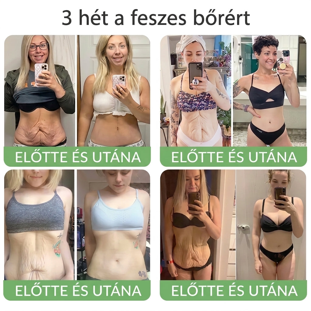 🎁 Már csak 5 üveg HISKIN® maradt! Spóroljon extra 30%-ot még ma – támogassa bőre hidratáltabb, feszesebb és fiatalosabb megjelenését, mielőtt véget ér ez a korlátozott idejű ajánlat!