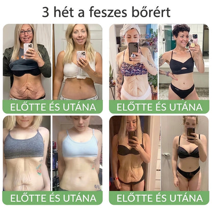 🎁 Már csak 5 üveg HISKIN® maradt! Spóroljon extra 30%-ot még ma – támogassa bőre hidratáltabb, feszesebb és fiatalosabb megjelenését, mielőtt véget ér ez a korlátozott idejű ajánlat!